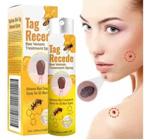 Tag Recede™ – Elimina verrugas sin dolor en casa, piel limpia en solo días