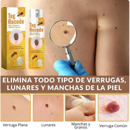 Tag Recede™ – Elimina verrugas sin dolor en casa, piel limpia en solo días